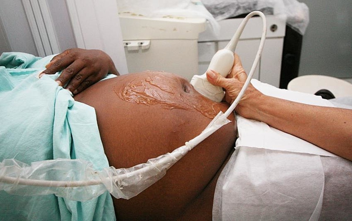 gravidez-mulheres-negras